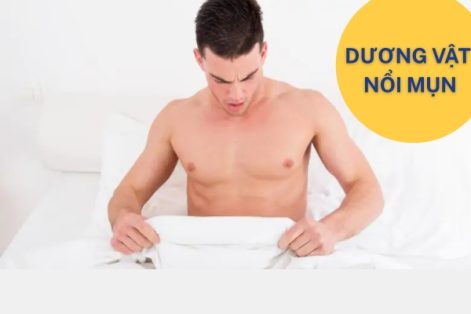 Địa chỉ trị dương vật nổi mụn uy tín hiện nay