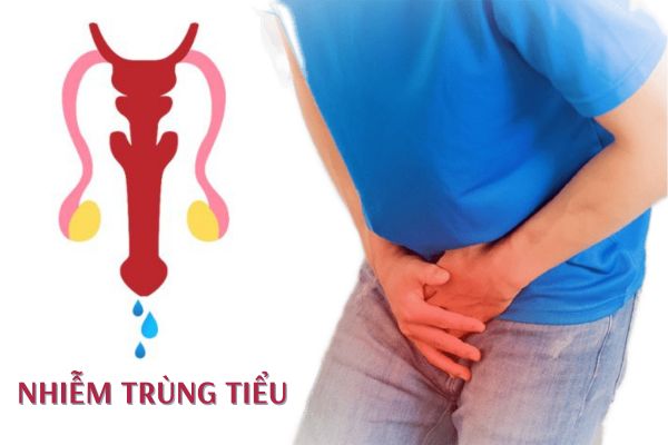 Nhiễm trùng tiểu ở nam giới và những thông tin cần biết